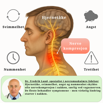 Illustrasjon av nervekompresjon i nakken som forårsaker nakkesmerter, svimmelhet, tåke i hodet og hodepine